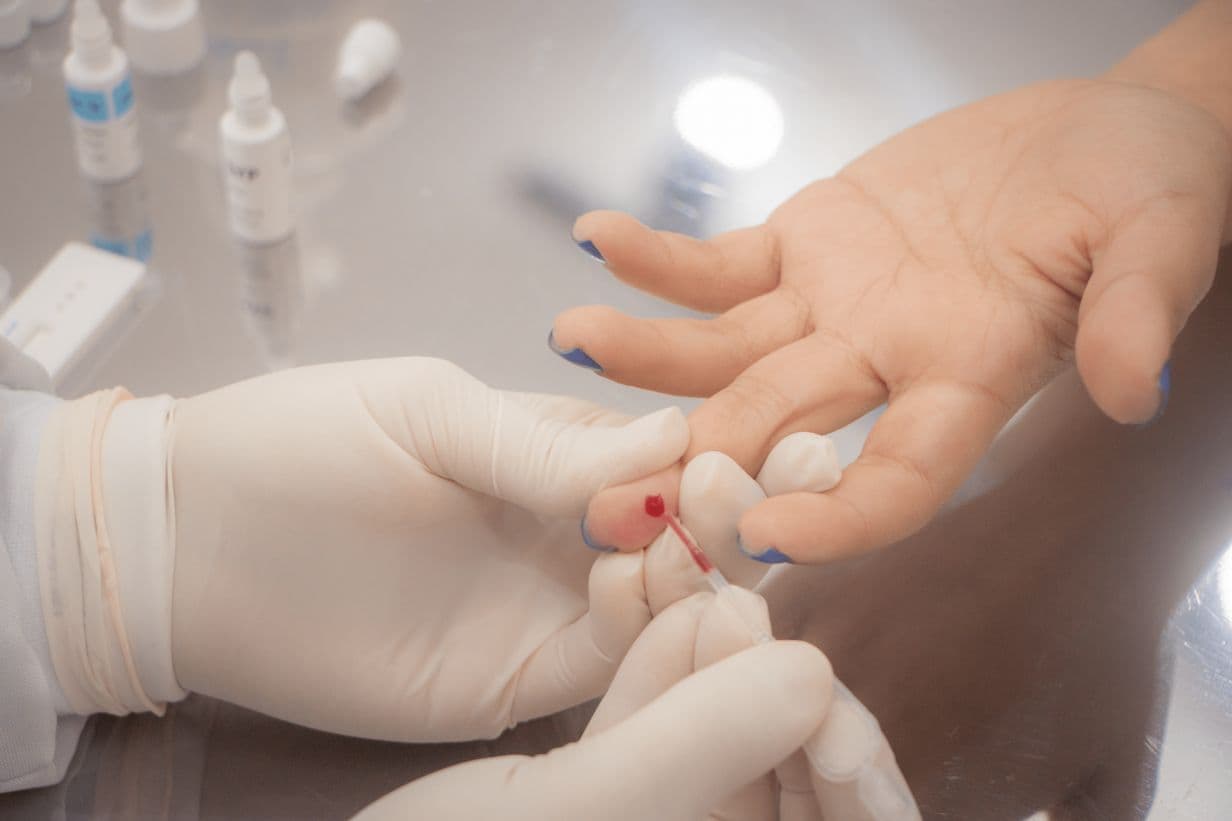 UEPG promove campanha sobre Hepatites Virais com testes rápidos