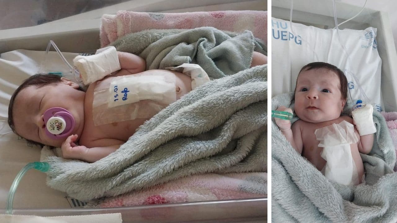 Bebê de um mês aguarda no HUMAI por cirurgia de emergência após marca-passo infeccionar