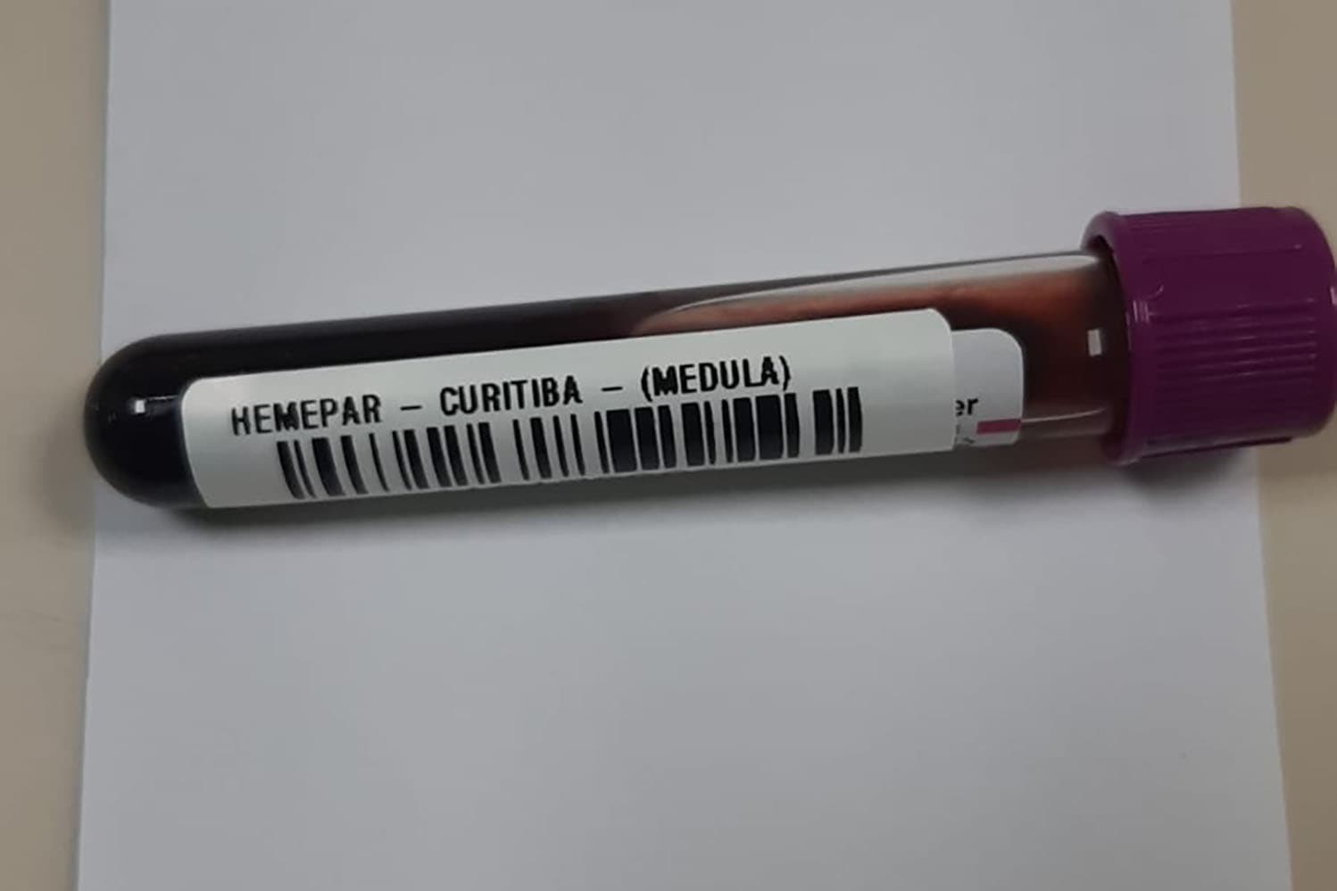 ‘Fevereiro Laranja’, mês da conscientização sobre leucemia, reforça importância do diagnóstico