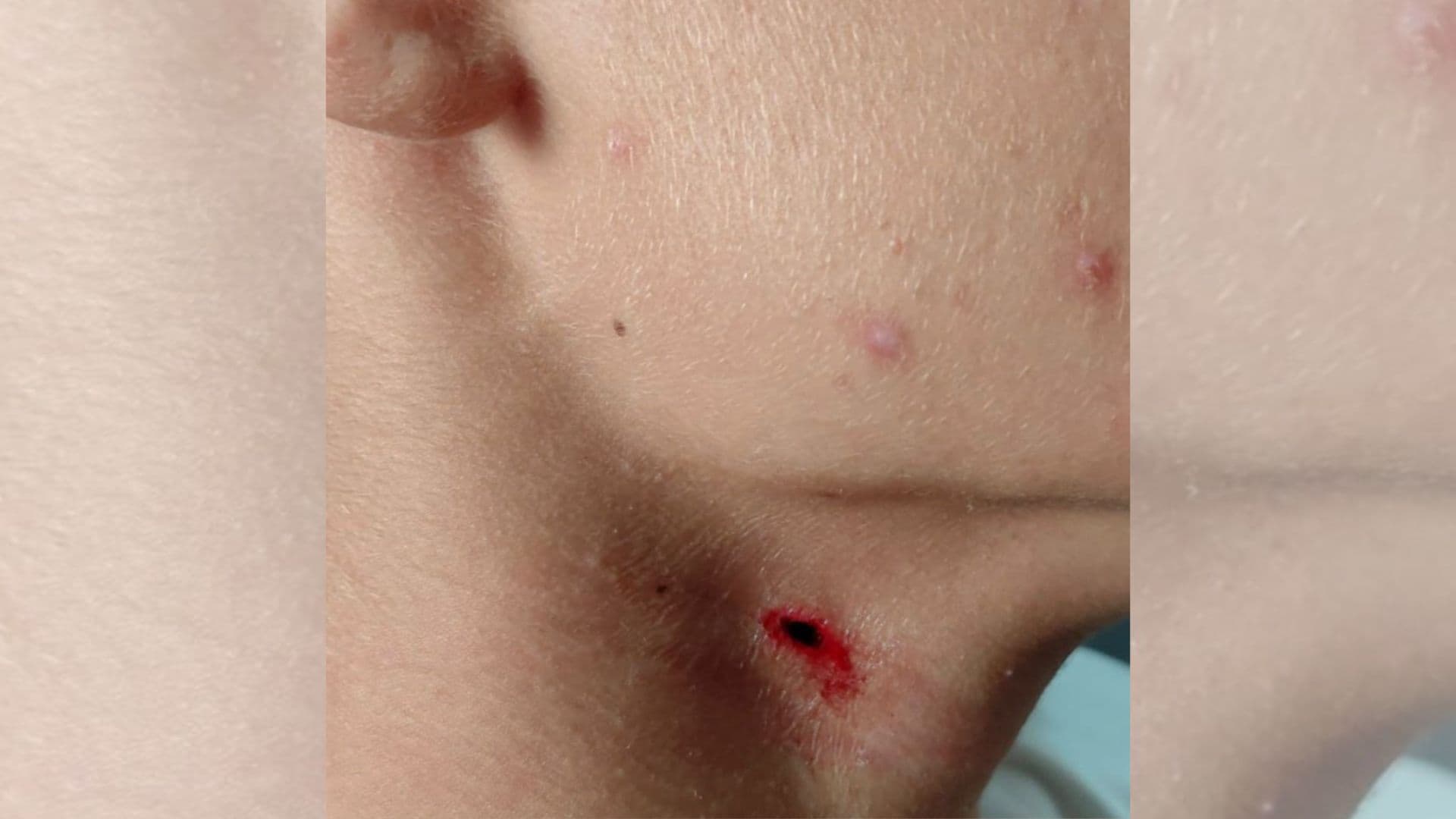 Menor é apreendido ao golpear com caneta pescoço de adolescente em Ponta Grossa